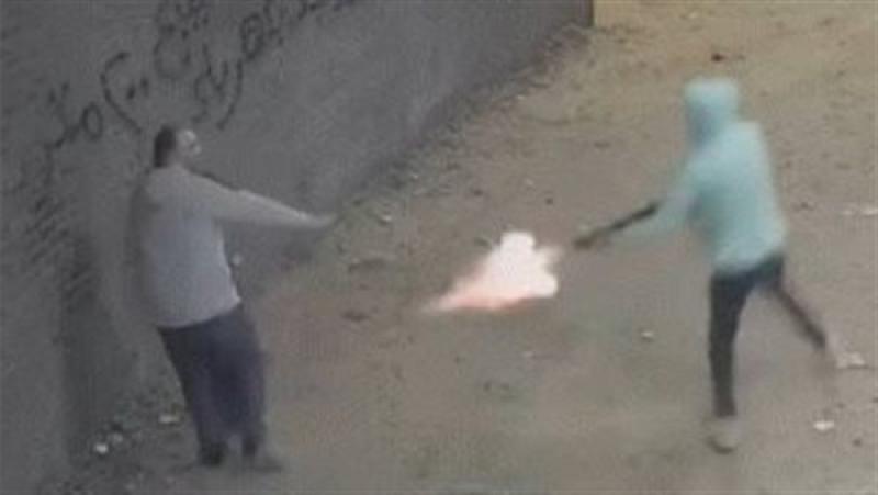 هل تم بتر قدمة؟.. آخر تطورات الحالة الصحية للطفل محمد المصاب بطلق خرطوش في باسوس